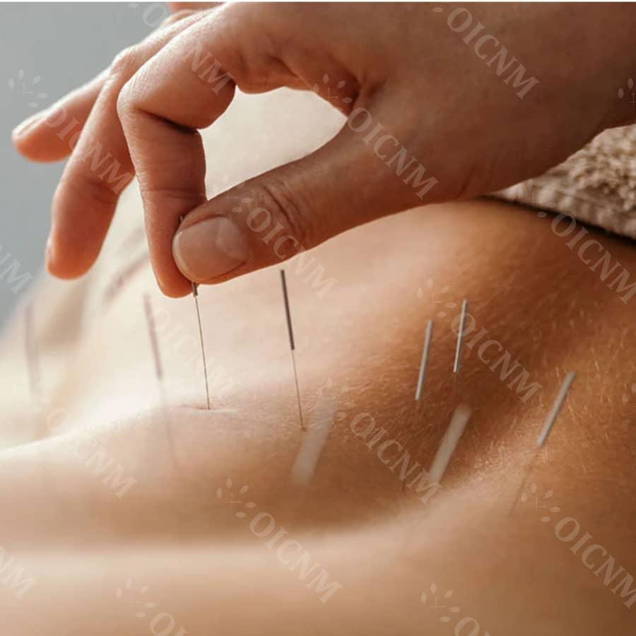 Balancing Energy: An Introduction to Acupuncture and Traditional Chinese Medicine